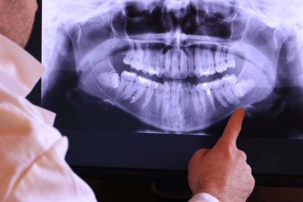 Professional Emergency Dental Service in GA