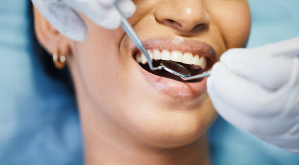 Best Broken or Chipped Tooth Repair in Morrow, GA
